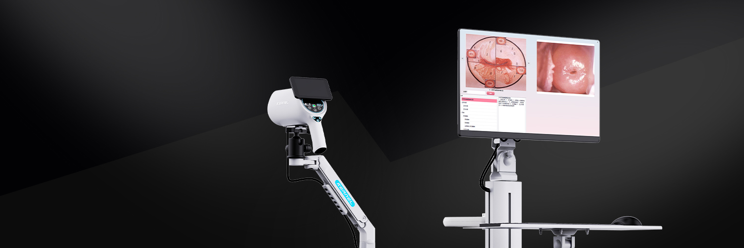 高分辨率高清晰度数码ccd