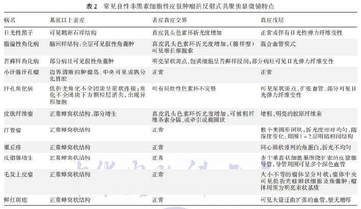 学术前沿丨常见非黑素细胞性皮肤肿瘤的反射式共聚焦显微镜特征专家共识(2025版)-03.jpg