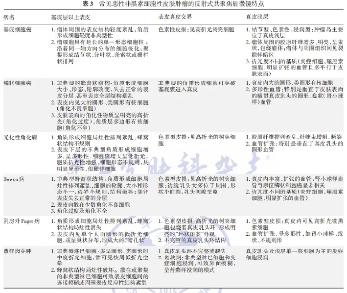 学术前沿丨常见非黑素细胞性皮肤肿瘤的反射式共聚焦显微镜特征专家共识(2025版)-14.jpg